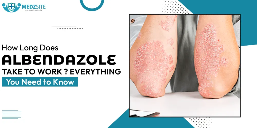 How Long Does Albendazole Take to Work? - Specialitymedz