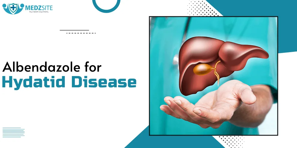 Albendazole for Hydatid Disease: Effective Treatment and Guidance