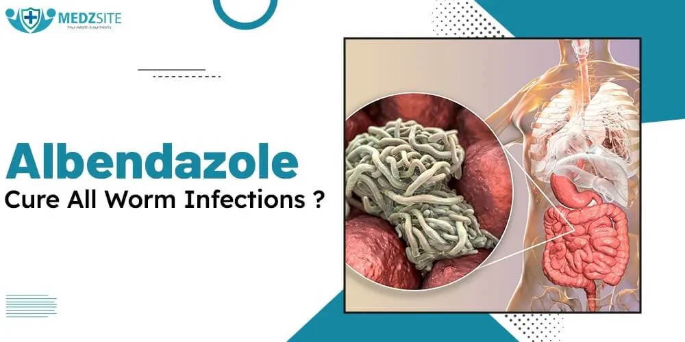 Can Albendazole Cure All Worm Infections? Understanding Its Effectiveness - Medzsite