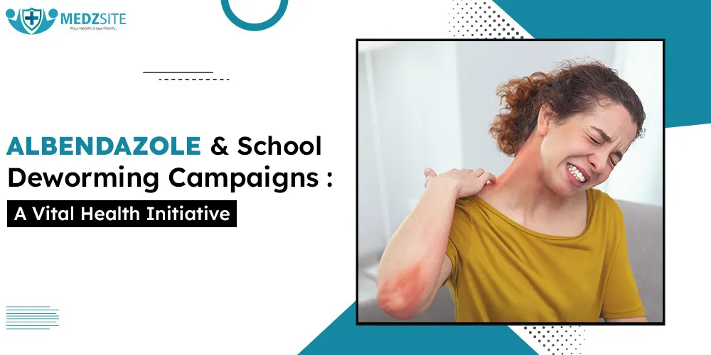 Albendazole and School Deworming Campaigns: A Vital Health Initiative