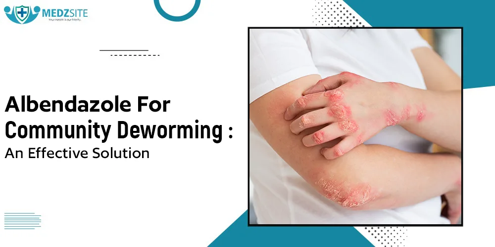 Albendazole for Community Deworming: An Effective Solution