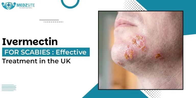 Ivermectin for Scabies: Effective Treatment in the UK